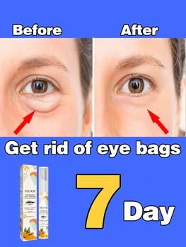 Anti-wrinkle Eye Cream Efficacemente Eliminare le occhiaie Borse sotto gli Occhi le Linee Sottili Intorno agli Occhi zampe di gallina Anti-wrinkle Eye Cream
